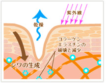 しわとは