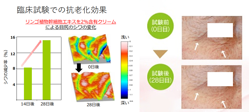 NEW］塗る糸リフト美容液【ドクターソワ】 | ビューティー専科